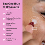 Spot Stoppers Pimple Patches (Pack of 30)