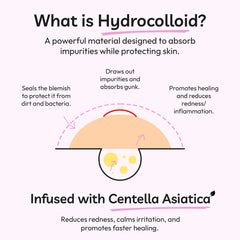 Spot Stoppers Pimple Patches (Pack of 30)