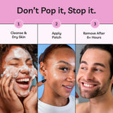 Spot Stoppers Pimple Patches (Pack of 30)