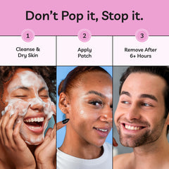 Spot Stoppers Pimple Patches (Pack of 30)