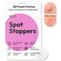 Spot Stoppers Pimple Patches (Pack of 30)